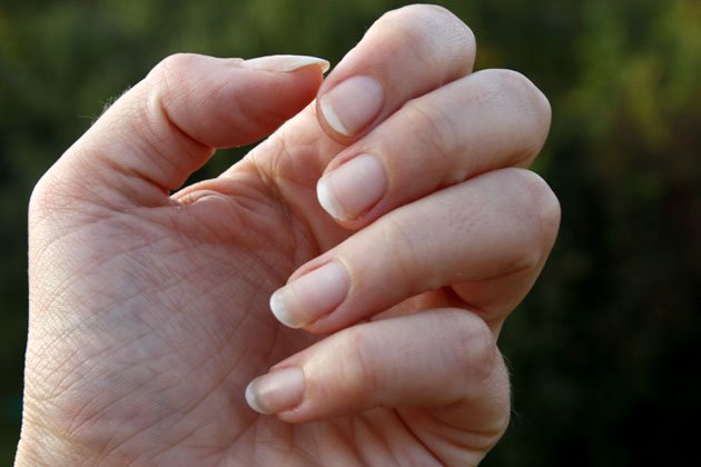 comment reparer les ongles qui se dedoublent