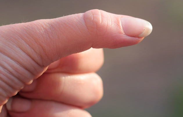 comment reparer des ongles dedoubles