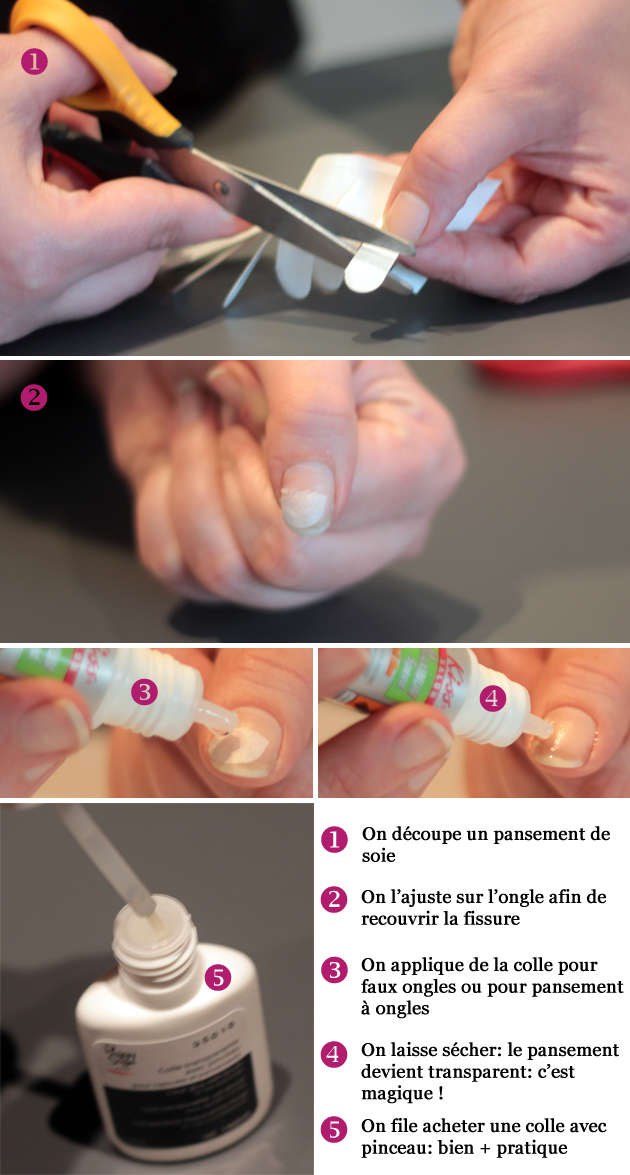 comment reparer les ongles
